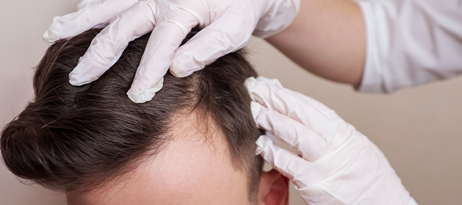 Diagnosis and Treatment of Hair and Scalp Diseases