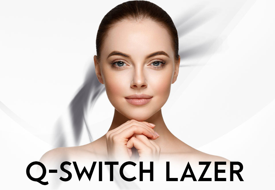 Q-Switch lazer